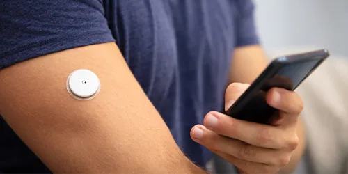 Nov 2025 Mem Acquisition Glucose Monitoring